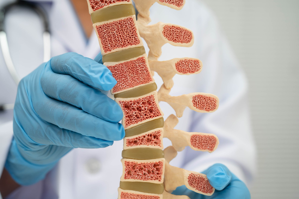 Osteoporosis